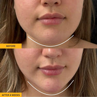 Gua Sha Brush for Snatched Face